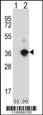 Anti-ANGPTL7 (N-term) Antibody
