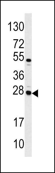 Anti-CASA (Center) Antibody