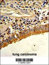 Anti-SPP1 (C-term) Antibody