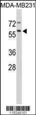 Anti-CTSF (Center D276) Antibody