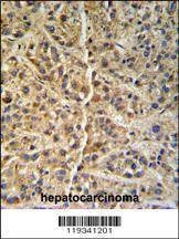 Anti-GNS (Center S298) Antibody