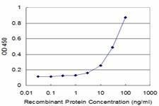 Anti-HOXC5 Antibody