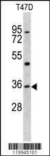 Anti-KLF6 (N-term) Antibody