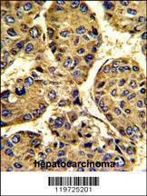 Anti-ASPN (Center) Antibody