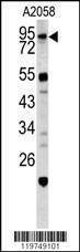 Anti-CALD1 (Center) Antibody