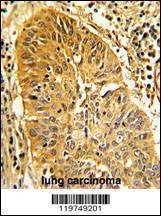 Anti-CALD1 (Center) Antibody