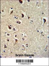 Anti-TIEG2 (N-term) Antibody