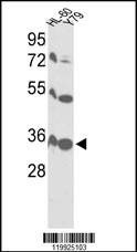 Anti-VDAC1 (Center) Antibody