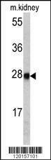 Anti-ETHE1 (Center) Antibody