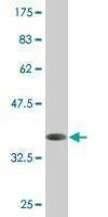 Anti-HOXD1 Antibody