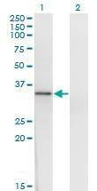 Anti-HOXD1 Antibody