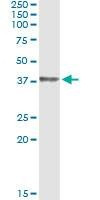 Anti-HOXD1 Antibody