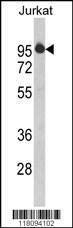 Anti-HTATSF1 (N-term) Antibody