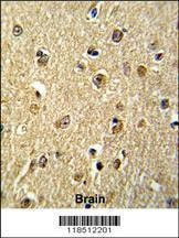 Anti-NKRF (Center) Antibody