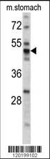 Anti-PDIA6 (Center K159) Antibody