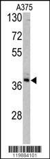 Anti-TALDO1 (Center) Antibody