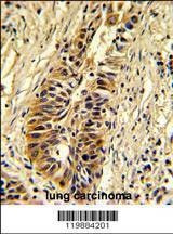Anti-TALDO1 (Center) Antibody