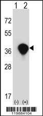 Anti-TALDO1 (Center) Antibody
