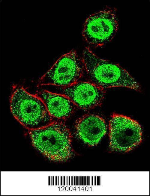 Anti-TYSY (C-term) Antibody