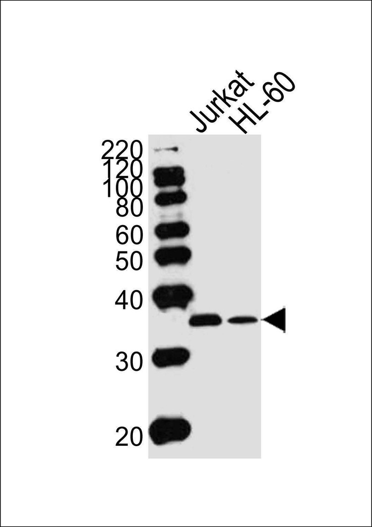 Anti-TYSY (C-term) Antibody