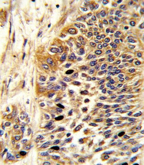 Anti-WNT4 (Center) Antibody