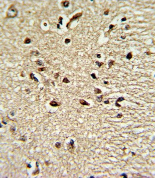 Anti-PAX4 (Center) Antibody