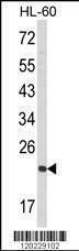 Anti-RAN (N-term) Antibody