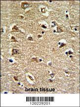 Anti-RAN (N-term) Antibody
