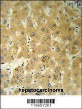 Anti-TTR (C-term) Antibody