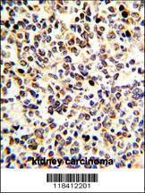 Anti-KRT10 (N-term) Antibody