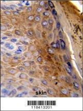 Anti-KRT10 (Center) Antibody
