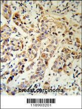 Anti-KRT13 (N-term) Antibody