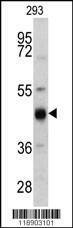 Anti-KRT13 (N-term) Antibody