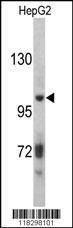Anti-ITIH2 (C-term) Antibody