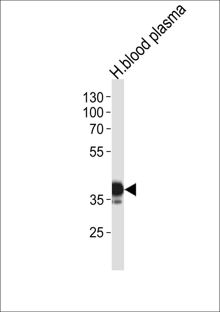 Anti-SERPINA7 (N-term) Antibody
