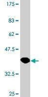 Anti-HPD Antibody