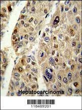 Anti-SERPINC1 (C-term) Antibody