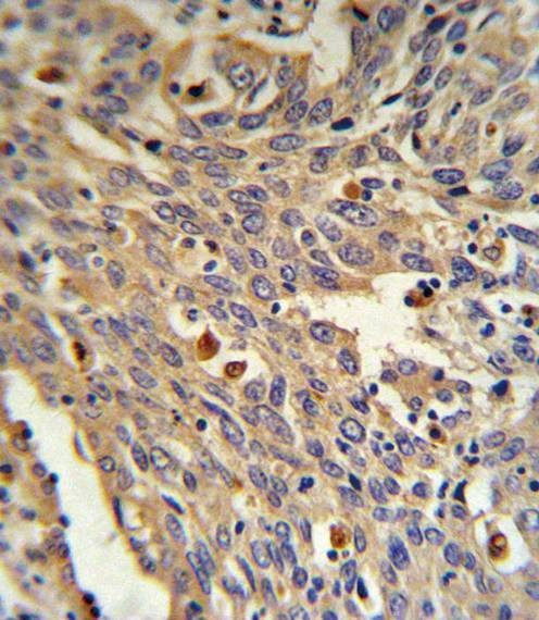 Anti-GLA (N-term) Antibody