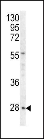 Anti-HPRT1 (C-term) Antibody