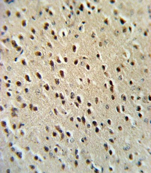 Anti-HPRT1 (C-term) Antibody