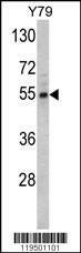 Anti-Fascin (Center) Antibody