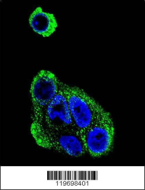 Anti-ADH1B (Center) Antibody