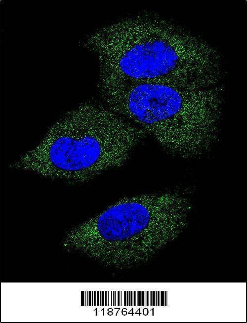 Anti-M-CSF (Center) Antibody