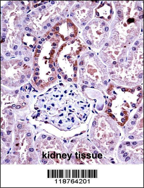 Anti-M-CSF (Center) Antibody