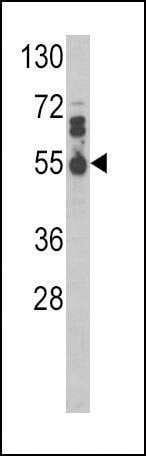 Anti-IL17RB (Center) Antibody