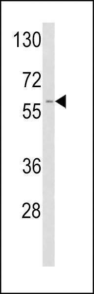 Anti-TPA (Center) Antibody