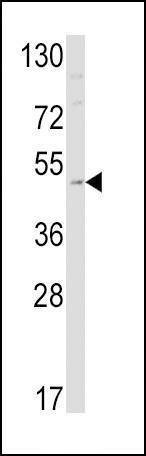 Anti-EDNRB (C-term) Antibody