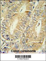 Anti-HPGD (C-term) Antibody