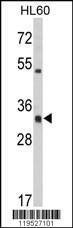 Anti-HLA-DRA (C-term) Antibody