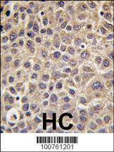 Anti-MTMR8 (C-term) Antibody